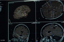 L'Institut du Cerveau accrot la performance de son stockage sans le dcentraliser