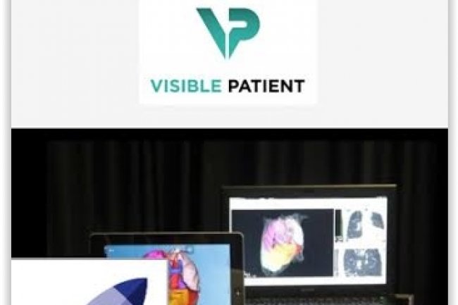 France Entreprise Digital : Dcouvrez aujourd'hui Visible Patient Service