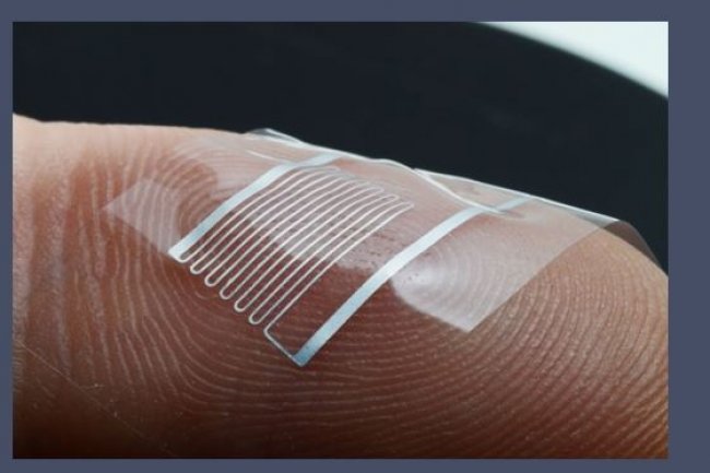 La recherche sur la mdecine biolectronique recourt  des implants miniaturiss capables de modifier les signaux lectriques qui passent le long des nerfs. (Source: EPFL/LSBI)