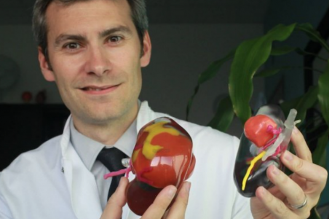 Le Dr Bernhard du CHU Bordeaux montre un rein issu d'une impression 3D. (Crdit D.R.)