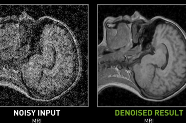 L'amélioration des images d'IRM constitue un débouché pour la technologie de réduction de bruit développée par Nvidia. (crédit : D.R.)