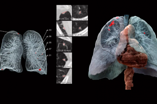 La GenAI meilleure que les médecins pour le diagnostic patient