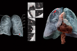 La GenAI meilleure que les mdecins pour le diagnostic patient