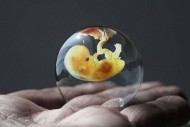 L'intelligence artificielle utilis�e pour la s�lection d'embryons